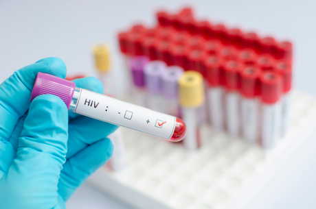 Autoteste para detecção do HIV estará disponível nas farmácias este ano