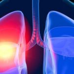 Inverno: 64% dos leitos pediátricos da Santa Casa de Santa Cruz são destinados aos pacientes com problemas respiratórios