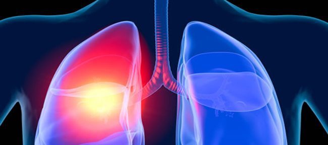 problemas-respiratorios-causas-sintomas-e-tratamentos-5