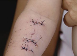 Bebê de 1 ano é atacado por macaco e recebe 20 pontos nos braços e na cabeça em Ourinhos